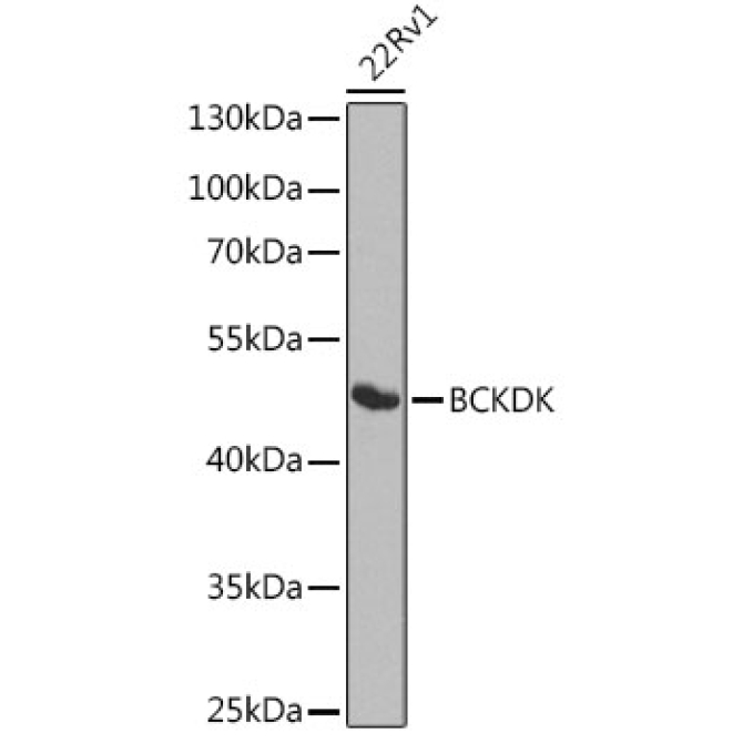 BCKDK Rabbit Polyclonal Antibody