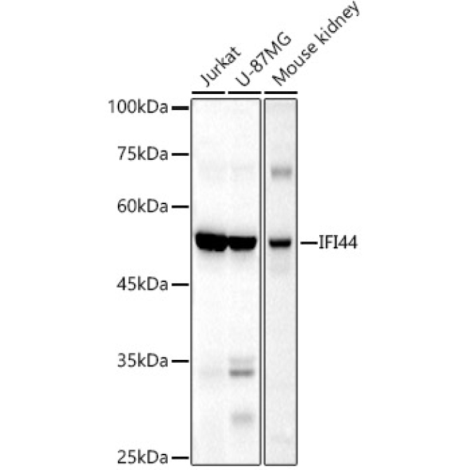 IFI44 Rabbit Polyclonal Antibody