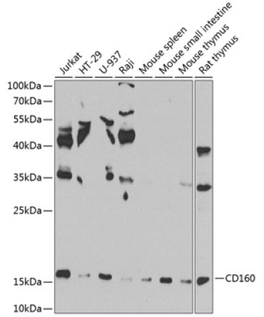 CD160 Rabbit Polyclonal Antibody