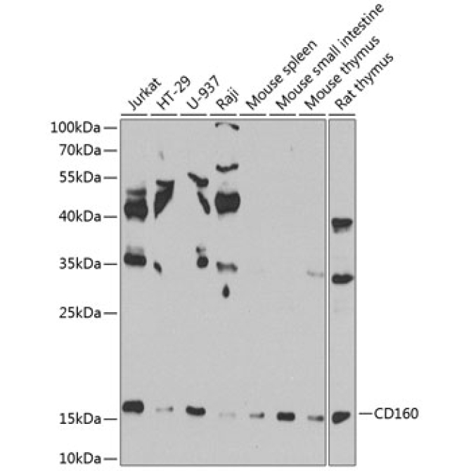 CD160 Rabbit Polyclonal Antibody