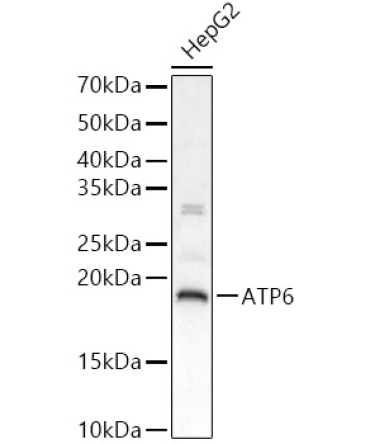 ATP6 Rabbit Polyclonal Antibody
