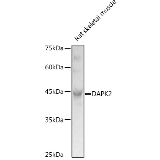 DAPK2 Rabbit Polyclonal Antibody