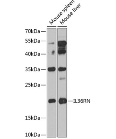 IL36RN Rabbit Polyclonal Antibody
