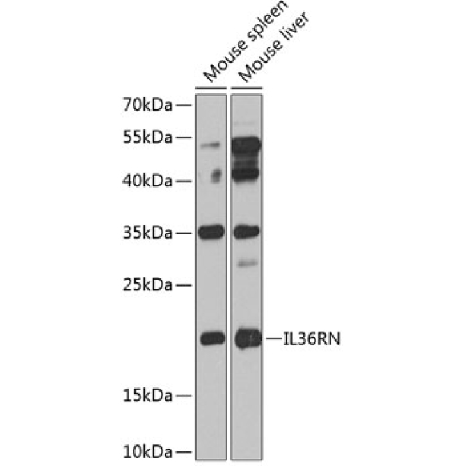 IL36RN Rabbit Polyclonal Antibody