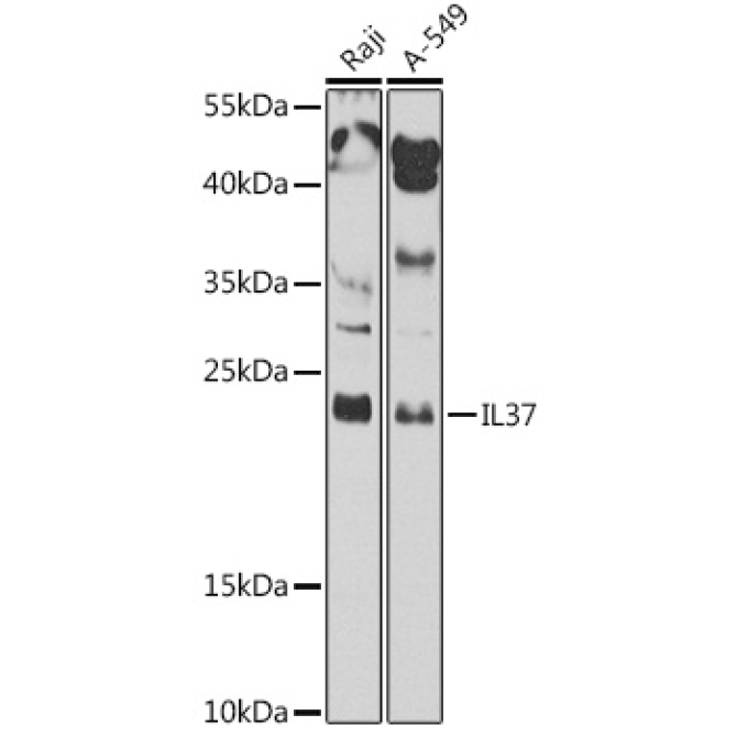 IL37 Rabbit Polyclonal Antibody