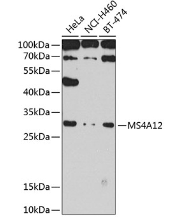MS4A12 Rabbit Polyclonal Antibody
