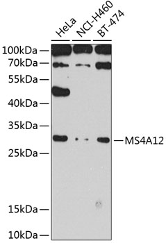 MS4A12 Rabbit Polyclonal Antibody