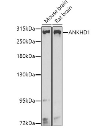ANKHD1 Rabbit Polyclonal Antibody