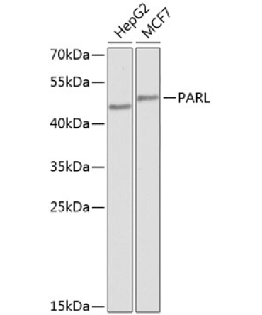 PARL Rabbit Polyclonal Antibody