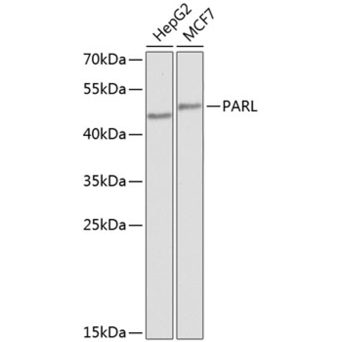 PARL Rabbit Polyclonal Antibody