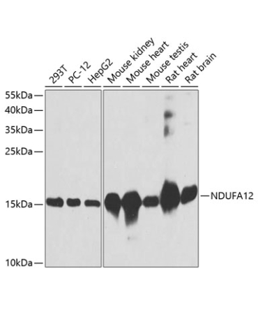NDUFA12 Rabbit Polyclonal Antibody