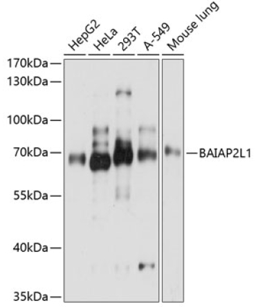 BAIAP2L1 Rabbit Polyclonal Antibody