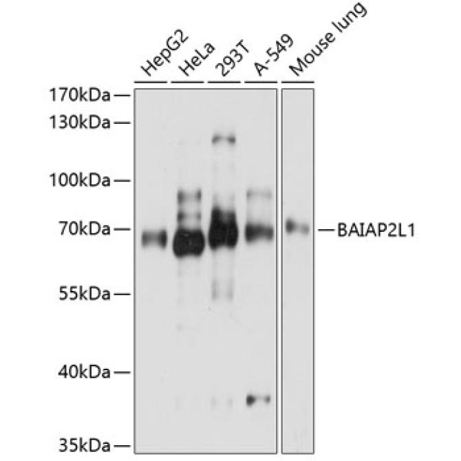 BAIAP2L1 Rabbit Polyclonal Antibody