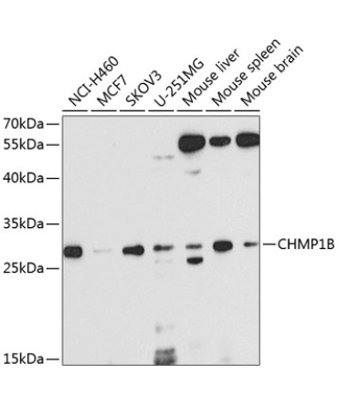 CHMP1B Rabbit Polyclonal Antibody