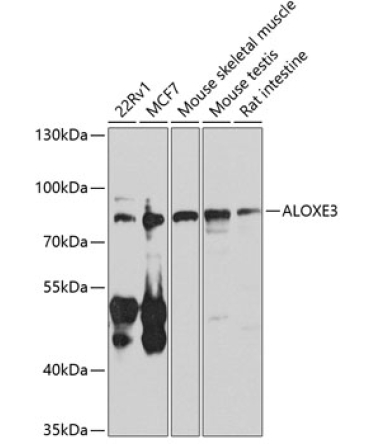 ALOXE3 Rabbit Polyclonal Antibody