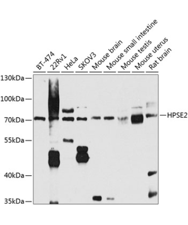 HPSE2 Rabbit Polyclonal Antibody