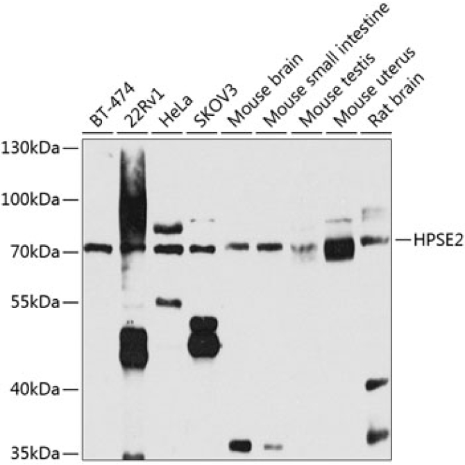 HPSE2 Rabbit Polyclonal Antibody