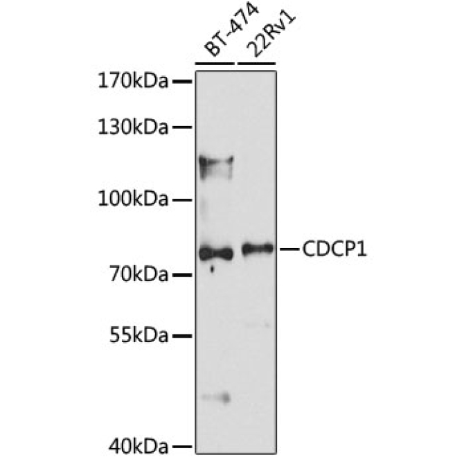 CDCP1 Rabbit Polyclonal Antibody