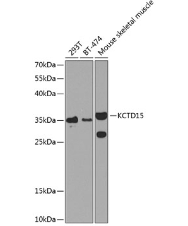 KCTD15 Rabbit Polyclonal Antibody