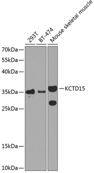 KCTD15 Rabbit Polyclonal Antibody