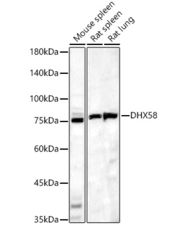 DHX58 Rabbit Polyclonal Antibody