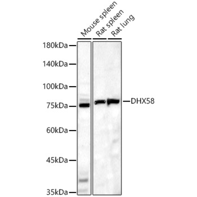 DHX58 Rabbit Polyclonal Antibody