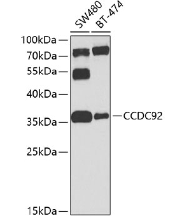 CCDC92 Rabbit Polyclonal Antibody
