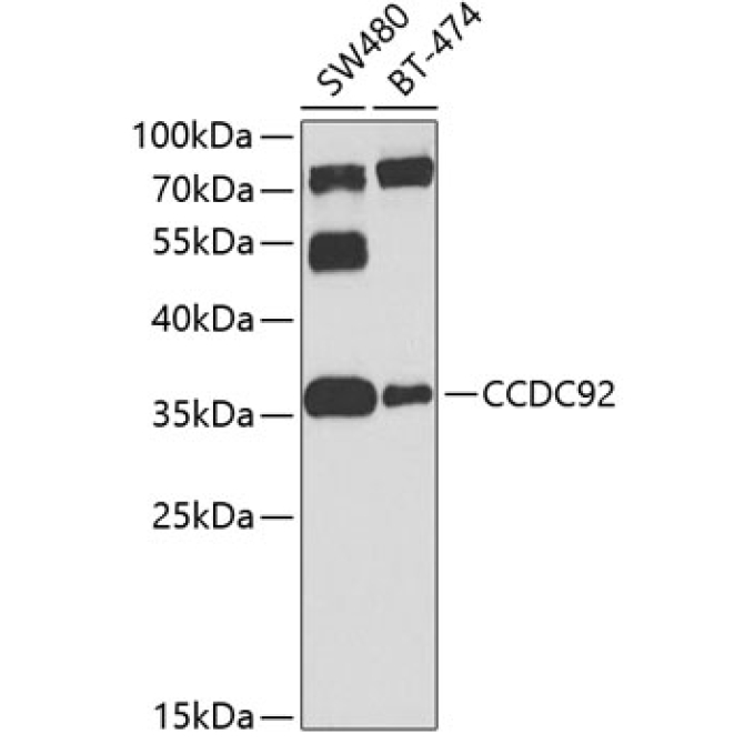 CCDC92 Rabbit Polyclonal Antibody