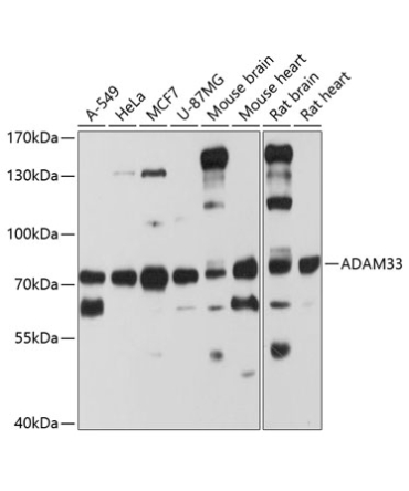 ADAM33 Rabbit Polyclonal Antibody