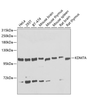 KDM7A Rabbit Polyclonal Antibody