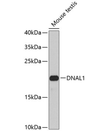 DNAL1 Rabbit Polyclonal Antibody