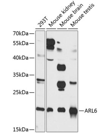ARL6 Rabbit Polyclonal Antibody