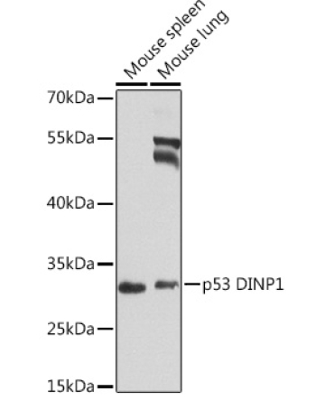 p53 DINP1 Rabbit Polyclonal Antibody