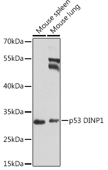 p53 DINP1 Rabbit Polyclonal Antibody