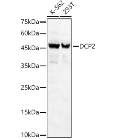 DCP2 Rabbit Polyclonal Antibody