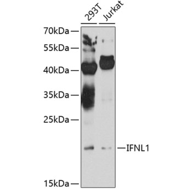 IFNL1 Rabbit Polyclonal Antibody