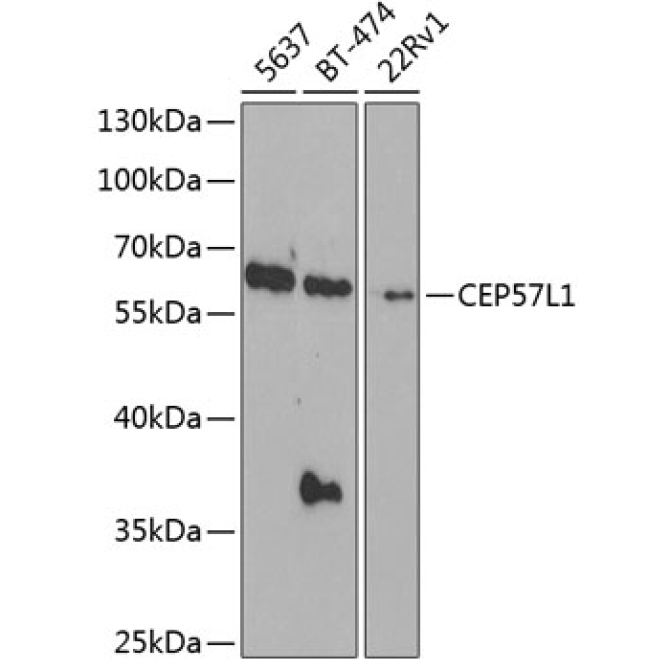CEP57L1 Rabbit Polyclonal Antibody