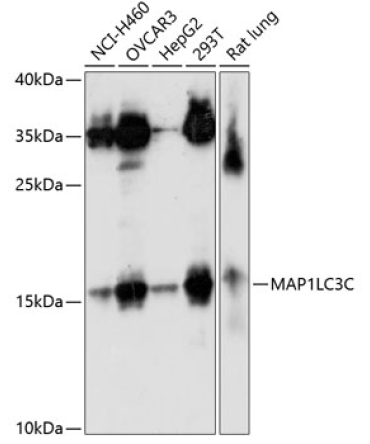 MAP1LC3C Rabbit Polyclonal Antibody