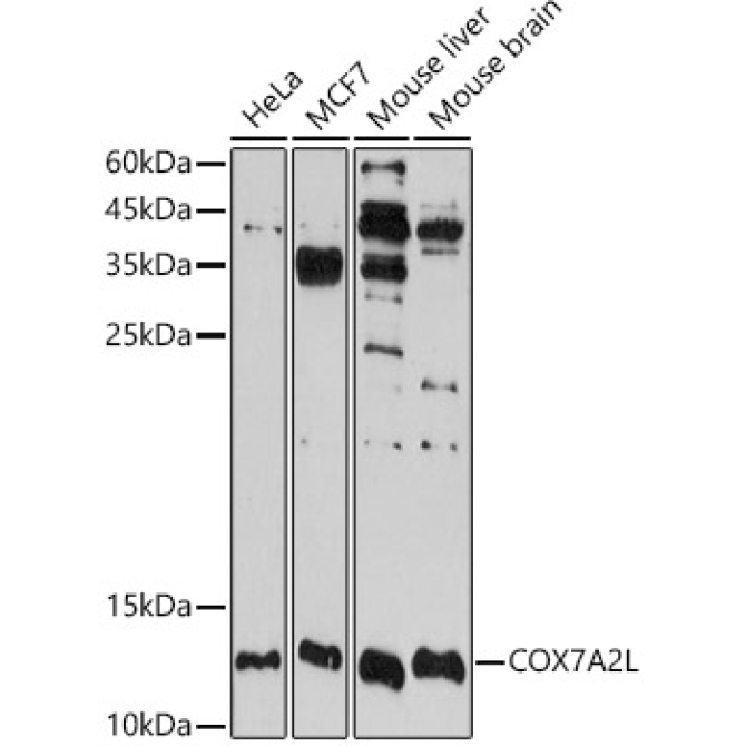 COX7A2L Rabbit Polyclonal Antibody