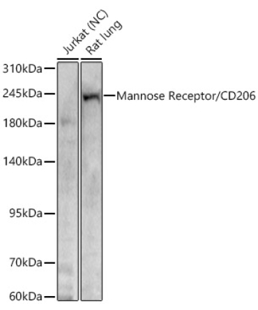 Mannose Receptor/CD206 Rabbit Polyclonal Antibody