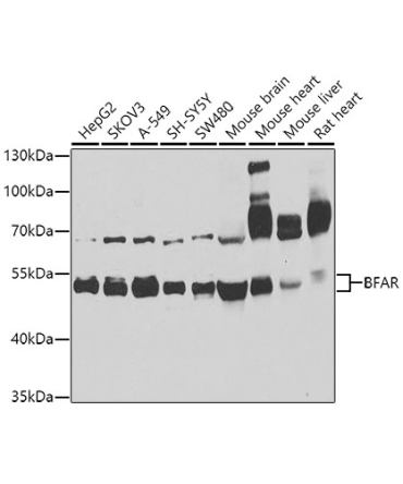 BFAR Rabbit Polyclonal Antibody