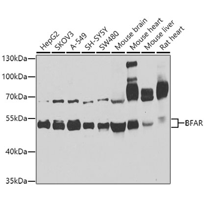 BFAR Rabbit Polyclonal Antibody