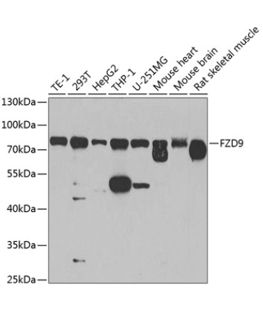 FZD9 Rabbit Polyclonal Antibody