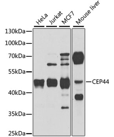 CEP44 Rabbit Polyclonal Antibody