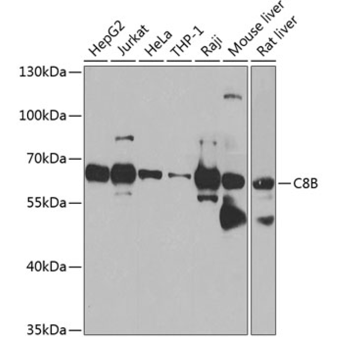 C8B Rabbit Polyclonal Antibody