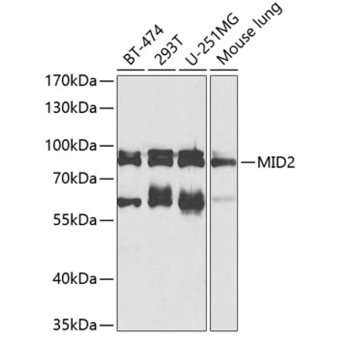 MID2 Rabbit Polyclonal Antibody