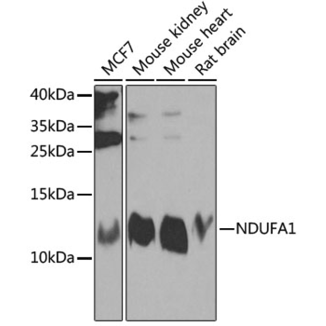 NDUFA1 Rabbit Polyclonal Antibody