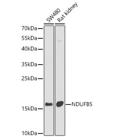 NDUFB5 Rabbit Polyclonal Antibody