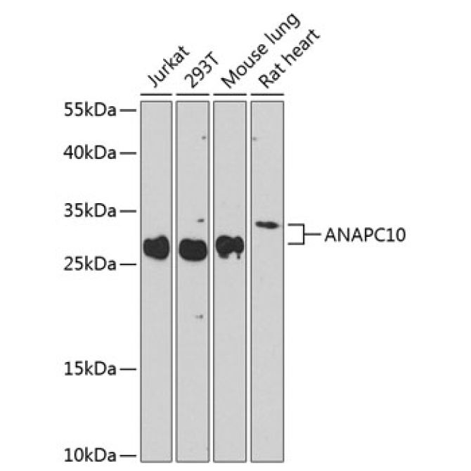 ANAPC10 Rabbit Polyclonal Antibody