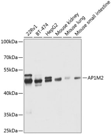 AP1M2 Rabbit Polyclonal Antibody
